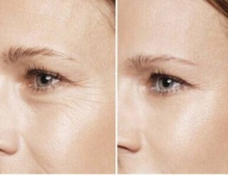 提前衰老、抵抗力差，用熟三七粉，抗衰還能補氣血！